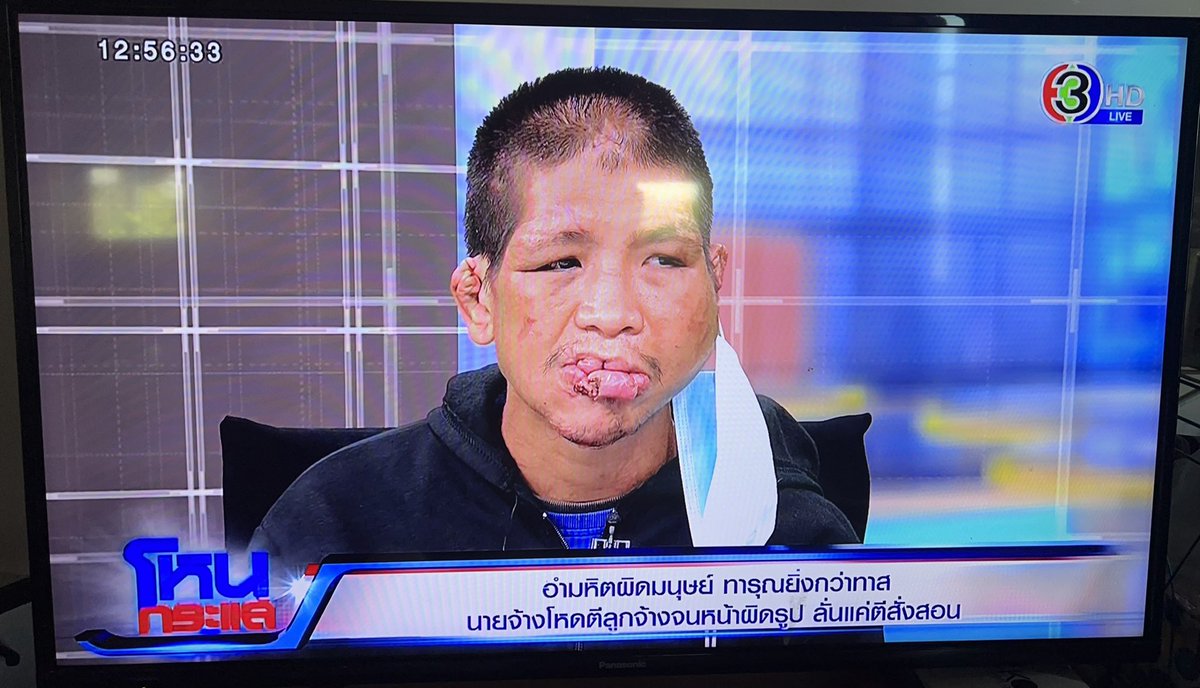 wavemad_110's tweet photo. อำมหิตผิดมนุษย์..ทารุณยิ่งกว่าทาส .
#โหนกระแส #สอดอ #แบนSITALA https://t.co/uXvZBN6chZ