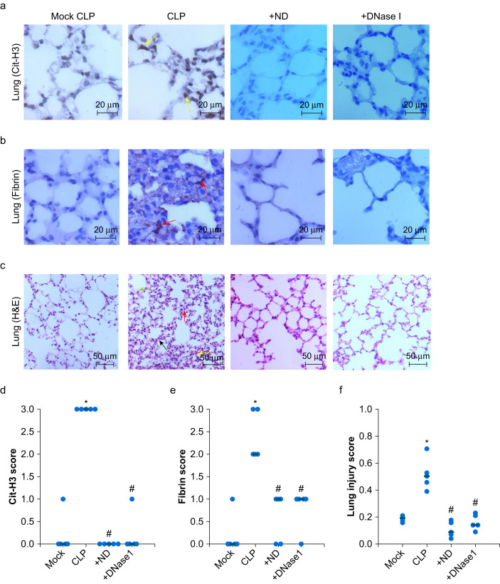 BJAJournals's tweet image. A novel NETs assay directly reflects NETs deposition within lungs and could be used to guide therapeutic targeting of CXCR1/2 in sepsis
@BJAJournals @CHToh1 

bit.ly/3IxHERm