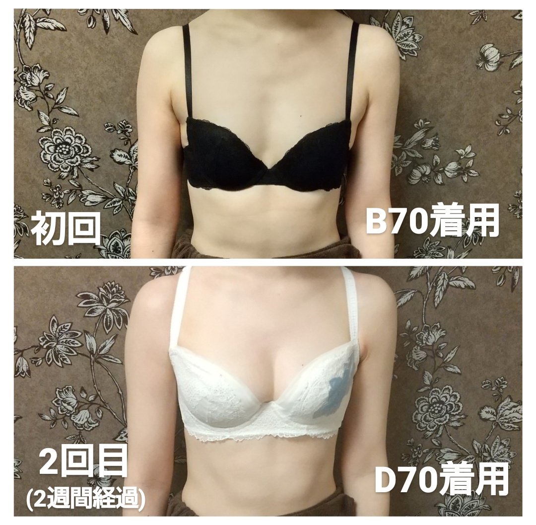 産後バスト Twitter Search Twitter 産後バスト Twitter Search Twitter