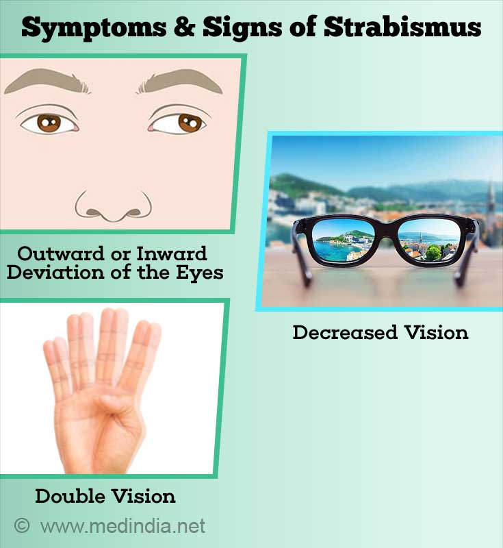 joptoophthal's tweet photo. Strabismus is an eye disorder in which the eyes don't look in exactly the same direction at the same time. Adults may develop strabismus from eye or blood vessel damage.
#Strabismus #eyedisorder #optometry #ophthalmology https://t.co/wBflJE2kTR