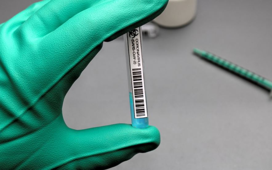 Novi podaci IJZ: Preminulo dvoje ljudi, 196 novooboljelih od koronavirusa

dnevne.me/dru%c5%a1tvo/-…