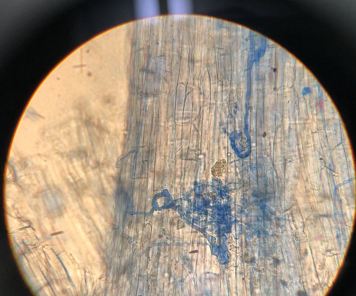 Mycocentriq's tweet photo. Mycorrhizae have my heart (and not just ECM…) 🍄 🌲 #arbuscules #glomeromycota #howmanynucleiwhoknows #titearbes https://t.co/XgDOPn2yDw