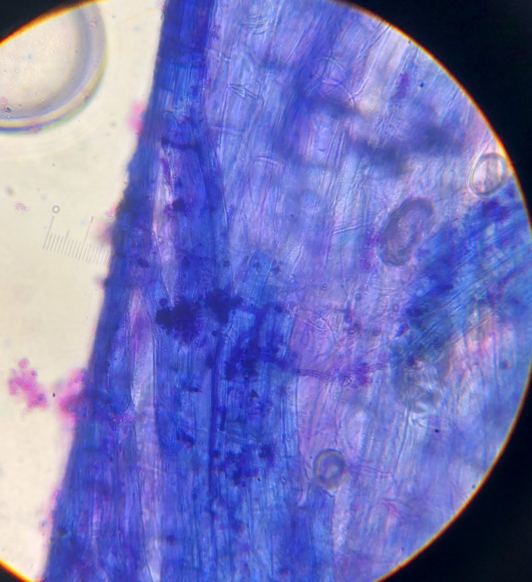 Mycocentriq's tweet photo. Mycorrhizae have my heart (and not just ECM…) 🍄 🌲 #arbuscules #glomeromycota #howmanynucleiwhoknows #titearbes https://t.co/XgDOPn2yDw