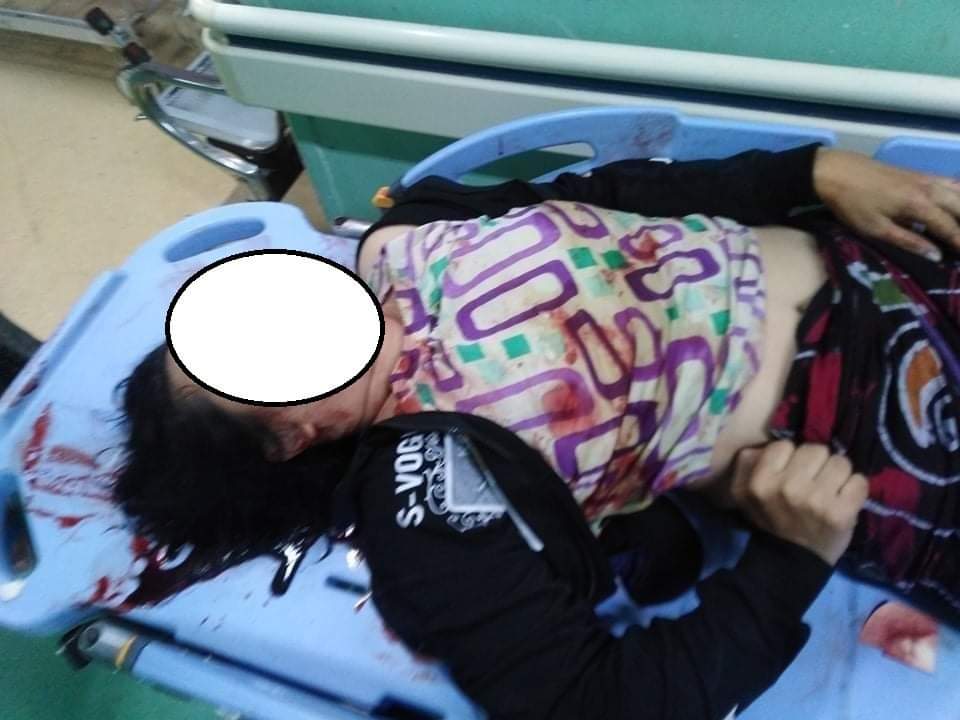 Jeonpyone's tweet photo. Today at around 5 40AM,Daw Khin Myo, NLD supporter was deliberately shot dead along with about 3 gunfires by military sponsored PyuSawHtee member.

#Dec8Coup 
#WhatsHappeningInMyanmar https://t.co/puiuG7oWvK