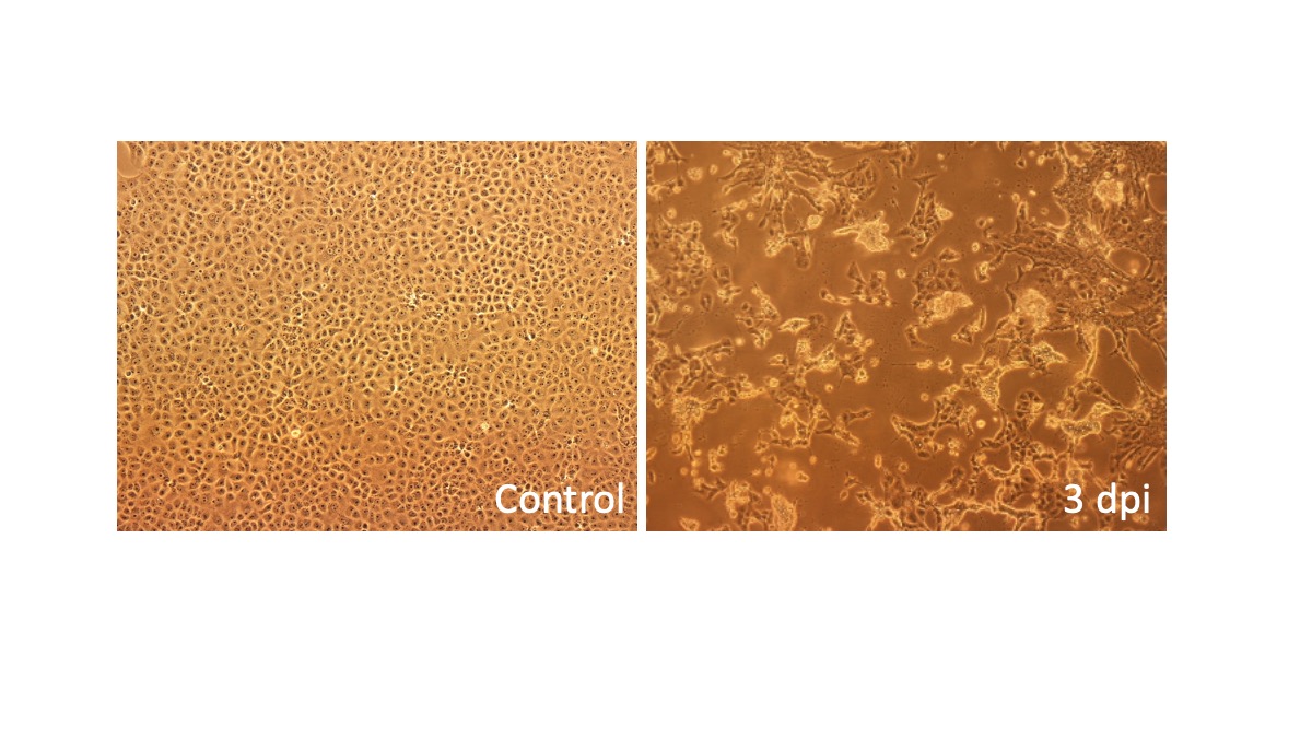 Isabella Eckerle (@eckerleisabella) on Twitter photo In case you're wondering what #Omicron looks like - Say hello to our new friend in the P3. Isolated from one of the first cases in #Switzerland. Now working hard to have some data soon - Thanks to <a href="/MBekliz/">Meriem Bekliz, PhD</a> & the whole <a href="/gcevd/">Geneva Centre for Emerging Viral Diseases</a> team! @Hopitaux_unige <a href="/UNIGEnews/">Université de Genève</a> <a href="/MIMOL_UNIGE/">MIMOL_UNIGE</a> #COVID19 In case you're wondering what #Omicron looks like - Say hello to our new friend in the P3. Isolated from one of the first cases in #Switzerland. Now working hard to have some data soon - Thanks to <a href="/MBekliz/">Meriem Bekliz, PhD</a> & the whole <a href="/gcevd/">Geneva Centre for Emerging Viral Diseases</a> team! @Hopitaux_unige <a href="/UNIGEnews/">Université de Genève</a> <a href="/MIMOL_UNIGE/">MIMOL_UNIGE</a> #COVID19