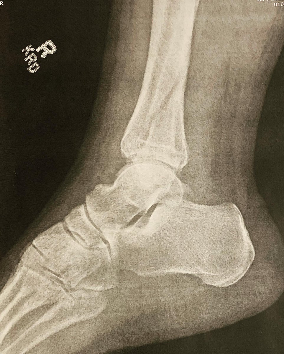 Chris Henrichsen tweet media