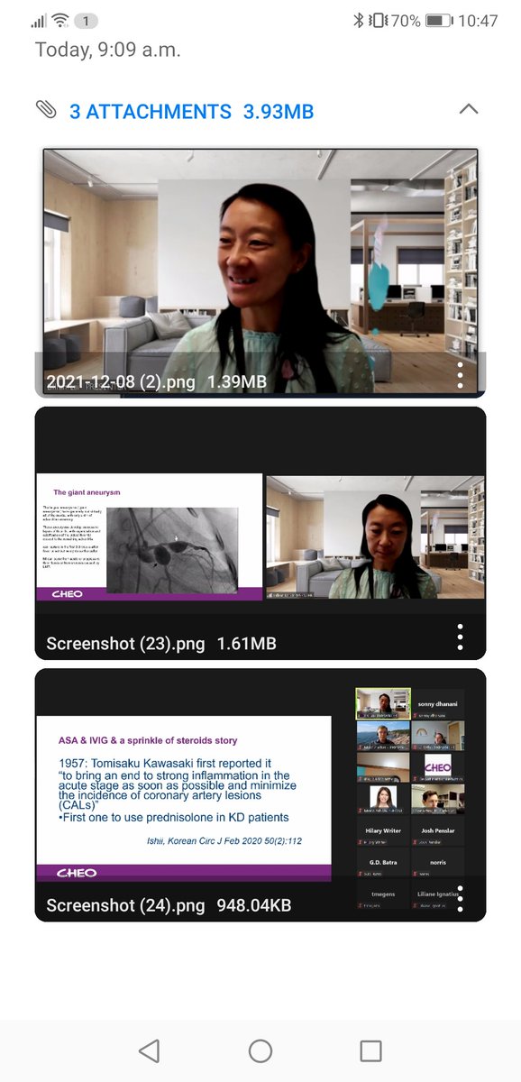 sonny dhanani (@sonnydhanani) on Twitter photo Dr Lai <a href="/CHEO/">CHEO Ottawa</a> grand rounds presenting on coronary artery disease after #COVID19 and #Kawasaki. She's got game. Dr Lai <a href="/CHEO/">CHEO Ottawa</a> grand rounds presenting on coronary artery disease after #COVID19 and #Kawasaki. She's got game.