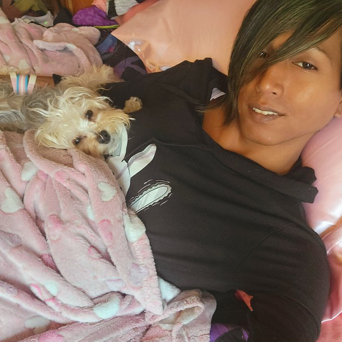 Recovery is going well ?
#topsurgery #mtof #hrt https://t.co/O0qM8Txd74