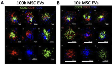 oniHQ's tweet photo. Very proud to be part of this publication by the Bussolati lab - "Surface Marker Expression in Small and Medium/Large Mesenchymal Stromal Cell-Derived #ExtracellularVesicles in Naive or Apoptotic Condition Using Orthogonal Techniques." https://t.co/VzcXwQzz41
