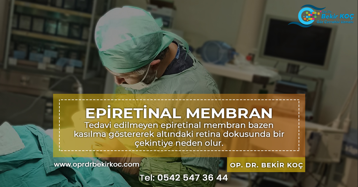 Malatya Göz Doktoru Op. Dr. Bekir Koç 
Epiretinal Membran Tedavisi
#malatya #oprdrbekirkoç #gözdoktoru #epiretinalmembran #gözsağlığı #gözdoktorumalatya #malatyagözdoktoru #gözhastalıkları #retinahastalıkları