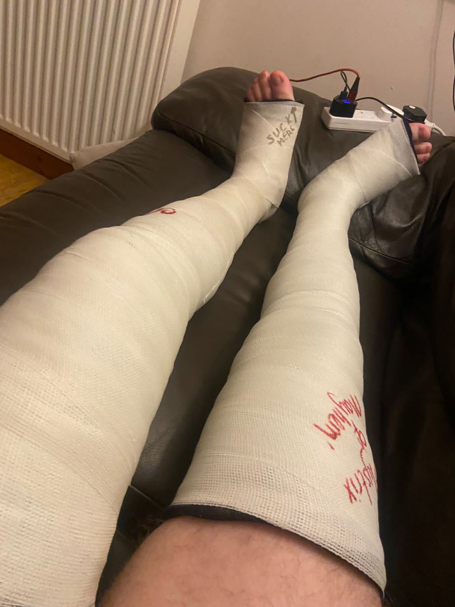 Purplejonesy's tweet photo. When @mystrix10 says she wants to practice doing casting, of course I gladly volunteer a leg. Wasn't happy with the first one so asked to try again...who am I to say no ๐คทโโ๏ธ.
#llc #legcast #longlegcast #fibre #fibrecast #cast #fulllegcast #getcasted #castfetish #castbondage https://t.co/ZdyxXhxByn