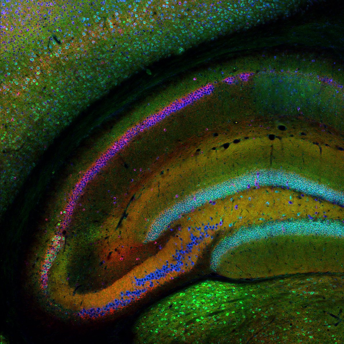 ACWhitebirch's tweet photo. Excited to participate in a live Q &amp; A session tomorrow when I present my virtual poster at #AES2021 - check it out if you're curious about changes to the CA2 subfield of the hippocampus in a mouse model of temporal lobe epilepsy! https://t.co/L290g5tluw