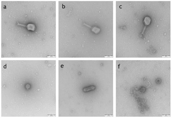 antibioticsmdpi's tweet photo. 📢Editor's Choice Article
Natural Bred ε2-Phages Have an Improved Host Range and #Virulence against #Uropathogenic #Escherichia coli over Their Ancestor #Phages by Dr. Florian Wagenlehner et al. from Justus-Liebig University Giessen @jlugiessen
👉https://t.co/YIZtPStCsv https://t.co/kg3ZMqISZl