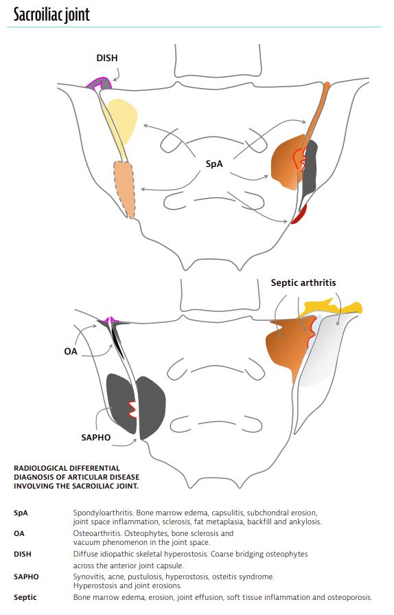 FREE PREVIEW of ARTHRITIS IMAGING
Doenoad here: cdn.shopify.com/s/files/1/0550…