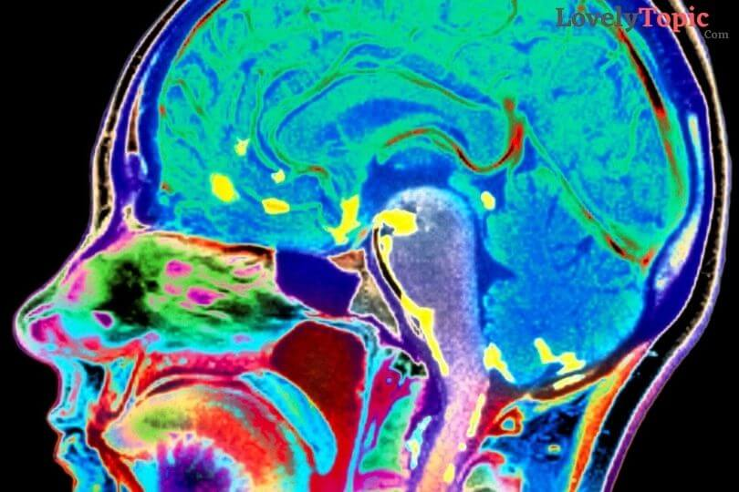 lovelytopic4u's tweet photo. Facts You Should Know About Neuro Infections
🌐https://t.co/IkZ4Q9rBXc
#HeadInjuryTreatment #Headache&amp;Migraine #Clinic, #NeurologicalInfection, #NeurologicalInfection #TreatmentTraumatic #HeadInjuryTreatment https://t.co/aLQwHUvkoe