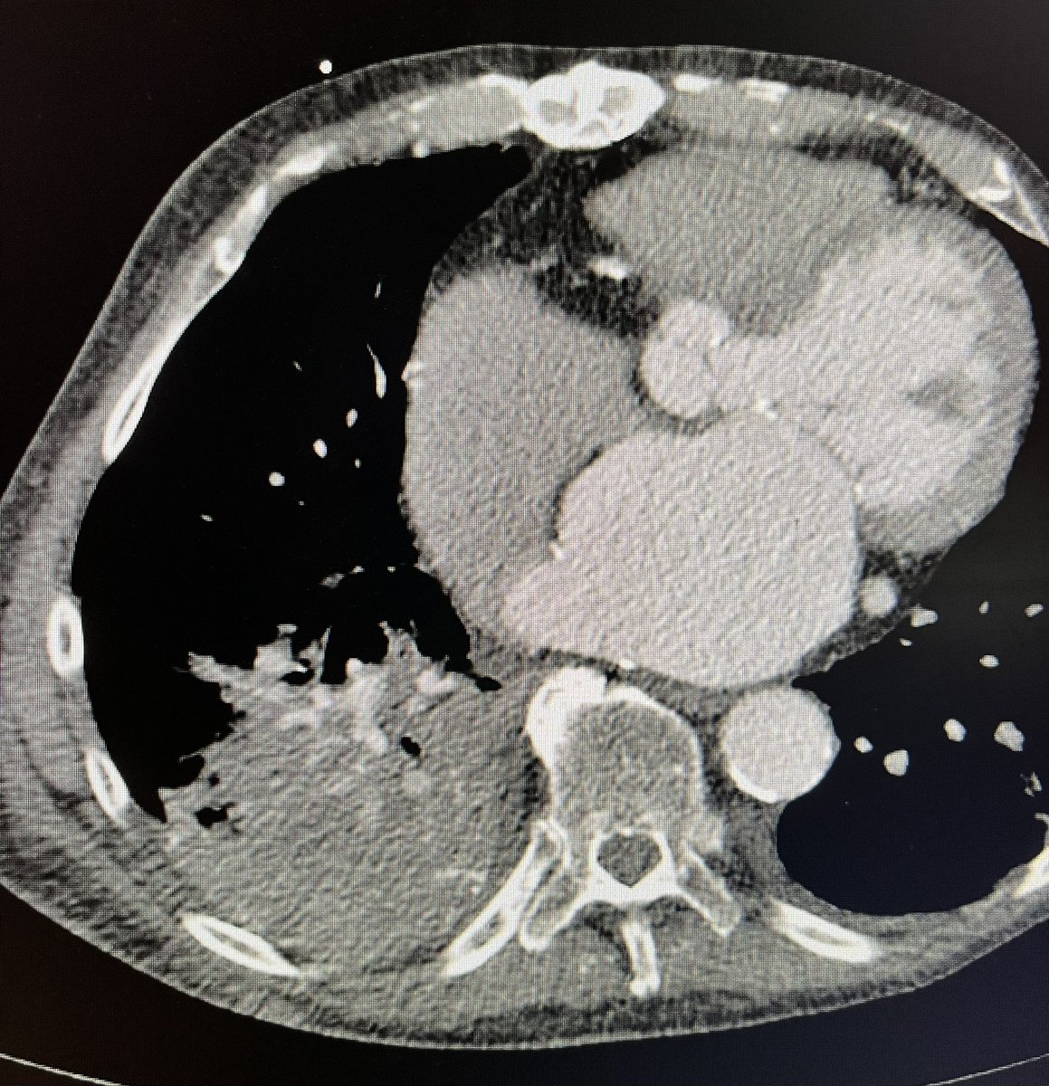 Brian Park MD, MS, CIIP tweet media