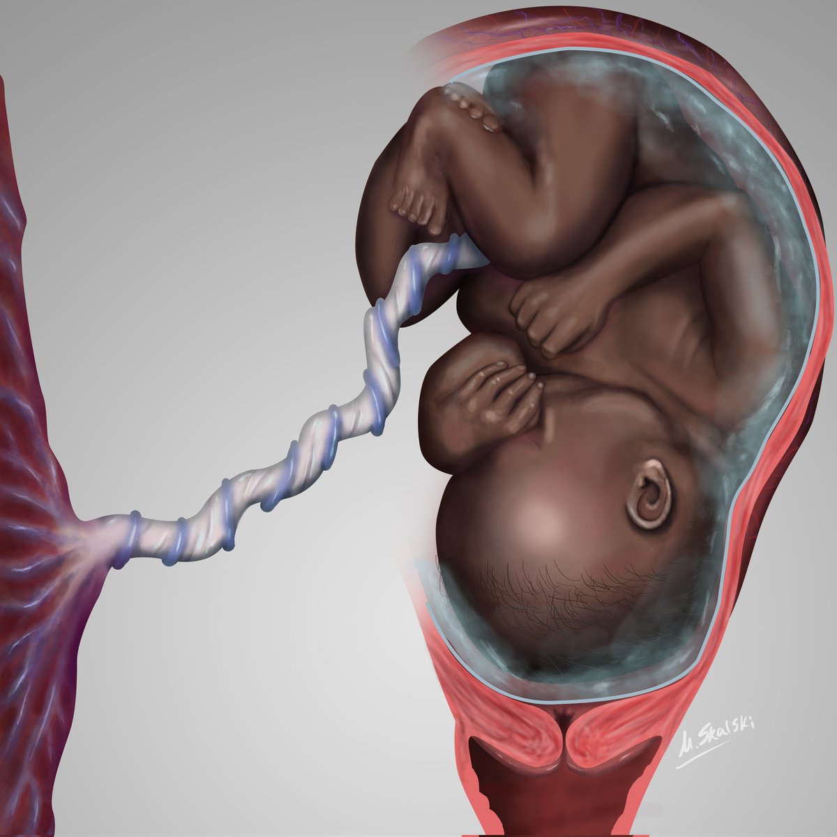 @LaveilAllenMD @ReedOmary @DrMarqBrad @SociologistRay @ErinCookeMD @ErikHessMD @DrKatieMDavis I made this recently. My version of an illustration from the famous text 'Anatomia Uteri Humani Gravidi Tabulis Illustrata' (1774)

 Really is appalling how little diversity exists in #medicalillustration.