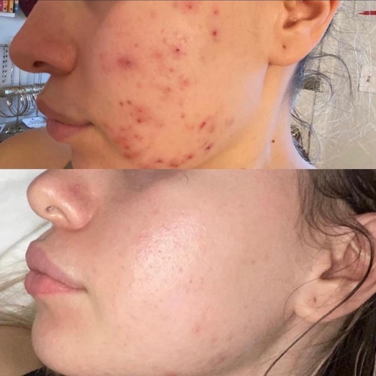 SteliCosmetics's tweet photo. The product + progress pictures using our 3 year best seller, After Dark Face Melt™ 〰

https://t.co/vf1xU0ifgE https://t.co/aEo93VLGHP