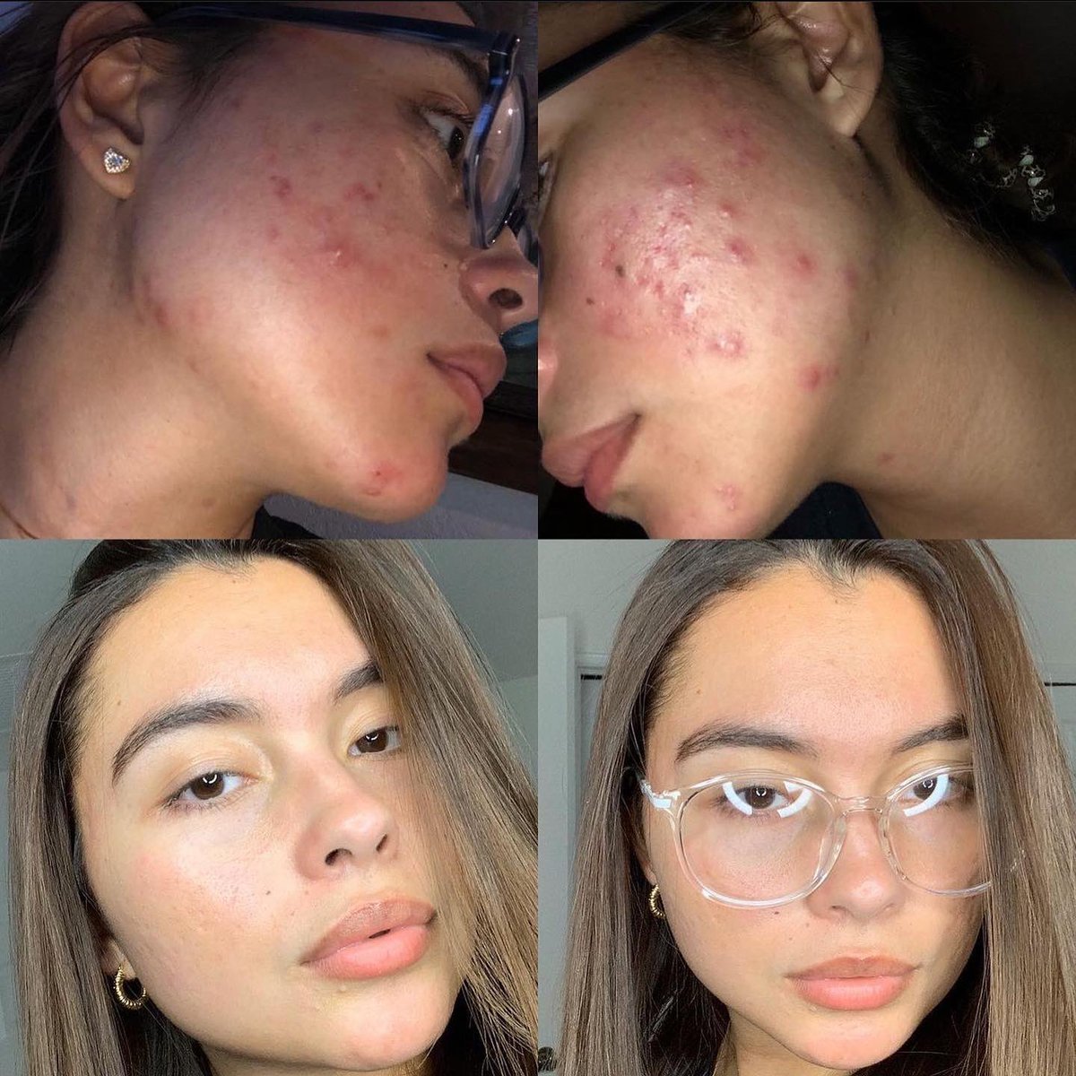SteliCosmetics's tweet photo. The product + progress pictures using our 3 year best seller, After Dark Face Melt™ 〰

https://t.co/vf1xU0ifgE https://t.co/aEo93VLGHP