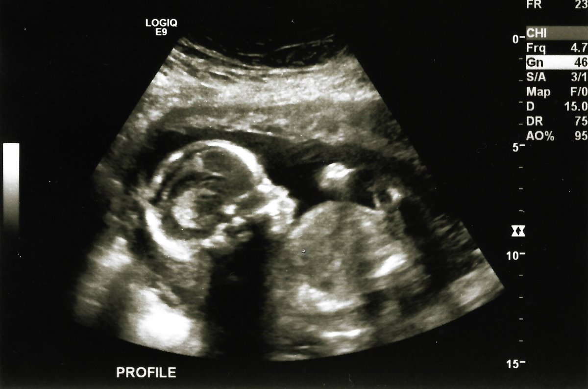 Kaitlin Bennett tweet media