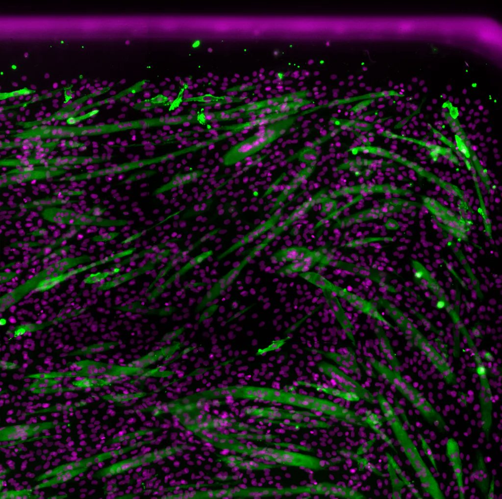 AraceliBio's tweet photo. A sneak peek of a full-well scan using the Araceli Endeavor #highcontentplatform, look at those crisp well edges and myotubes!
#completescan #cellbiology #highcontentscreening #myotubes #cellassay https://t.co/5owpRGojeM