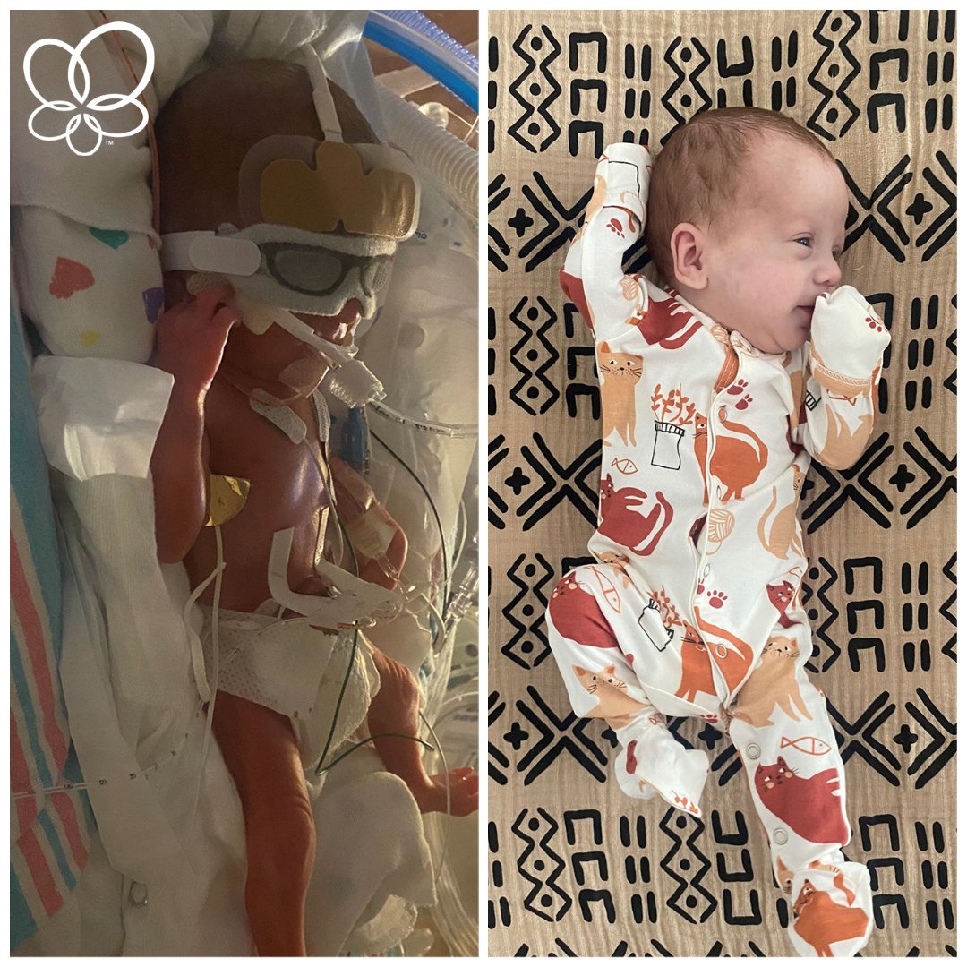 prolacta's tweet photo. #26weeker Crew received Prolacta’s fortifiers during his #NICU stay. Today he is 13 months old and is getting ready to take his first steps. 
https://t.co/5VHPqrVUkV 

#prematurityawarenessmonth https://t.co/2c9HBGHeB6