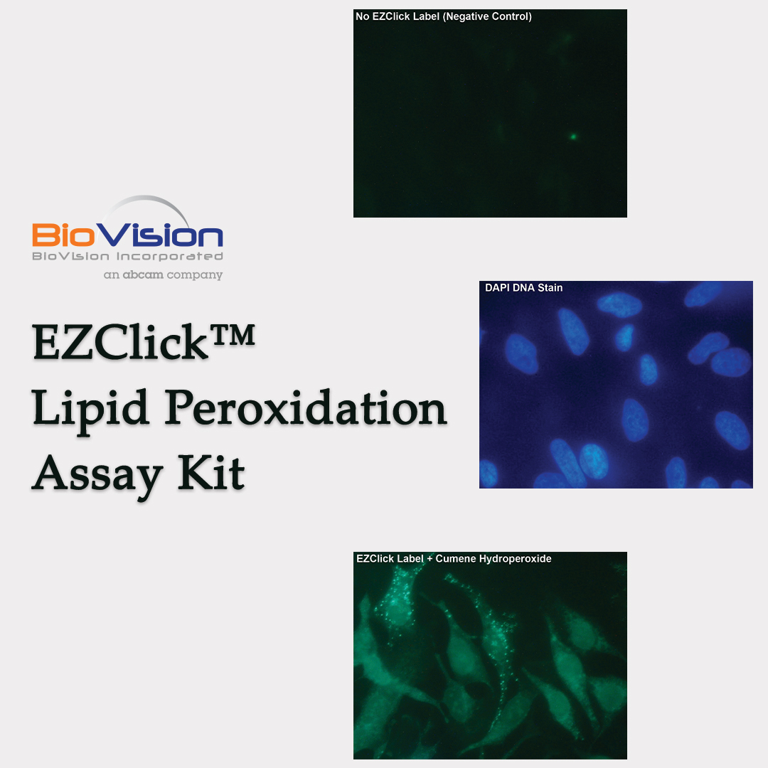 BioVision_Inc's tweet image. BioVision’s EZClick™ Lipid Peroxidation Assay Kit offers a specific, simple and robust method for labeling and detection of lipid peroxidation. hubs.ly/Q010wLP50   #biotech #biotechnology #science #biology #microbiology #research #dna #molecularbiology #lab