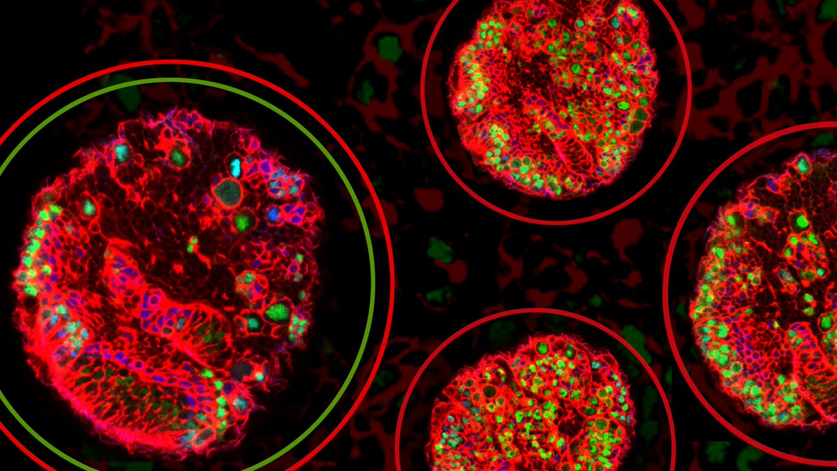 In a new <a href="/NatureComms/">Nature Communications</a> study, scientists have identified a key player that drives both embryonic and neuronal #StemCell fate in #drosophila. The new findings shed light on how cellular reprogramming factors, when improperly expressed, can lead to cancer.
myumi.ch/5Wmnz