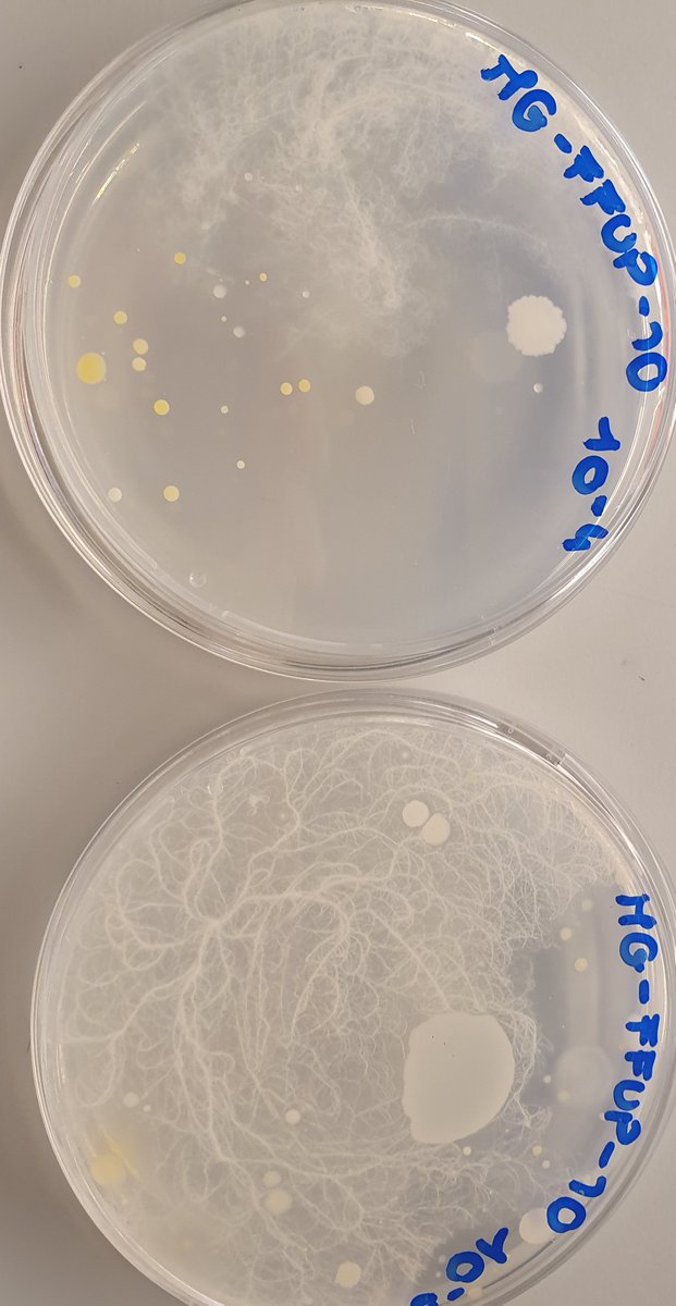 MicroMundoUP's tweet photo. Our MICRITA are excited to observe the microbial diversity found in their soil samples! Here some examples 👇 https://t.co/ddkuFwugd3