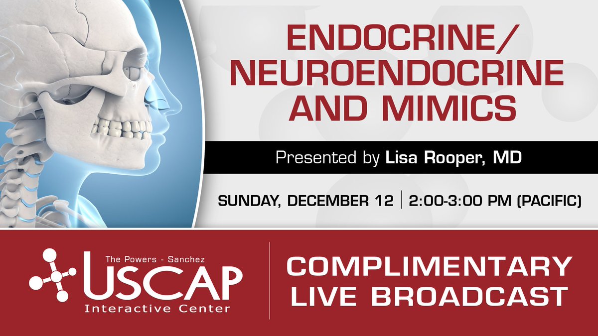 USCAP (@theuscap) on Twitter photo We'll be live on Facebook again this Sunday! Learn from <a href="/LisaRooperMD/">Lisa Rooper</a> as she discusses Endocrine/Neuroendocrine and Mimics and Soft Tissue Neoplasms of the Head and Neck
Find us on Facebook on Sunday, 12/12 at 2:00pm PST - facebook.com/TheUSCAP. No pre-registration required. We'll be live on Facebook again this Sunday! Learn from <a href="/LisaRooperMD/">Lisa Rooper</a> as she discusses Endocrine/Neuroendocrine and Mimics and Soft Tissue Neoplasms of the Head and Neck
Find us on Facebook on Sunday, 12/12 at 2:00pm PST - facebook.com/TheUSCAP. No pre-registration required.