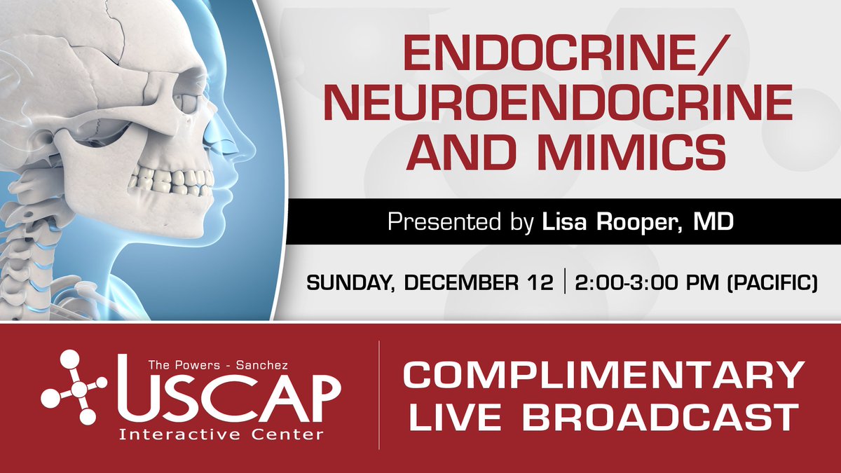 We'll be live on Facebook again this Sunday! Learn from @LisaRooperMD as she discusses Endocrine/Neuroendocrine and Mimics and Soft Tissue Neoplasms of the Head and Neck Find us on Facebook on Sunday, 12/12 at 2:00pm PST - facebook.com/TheUSCAP. No pre-registration required.