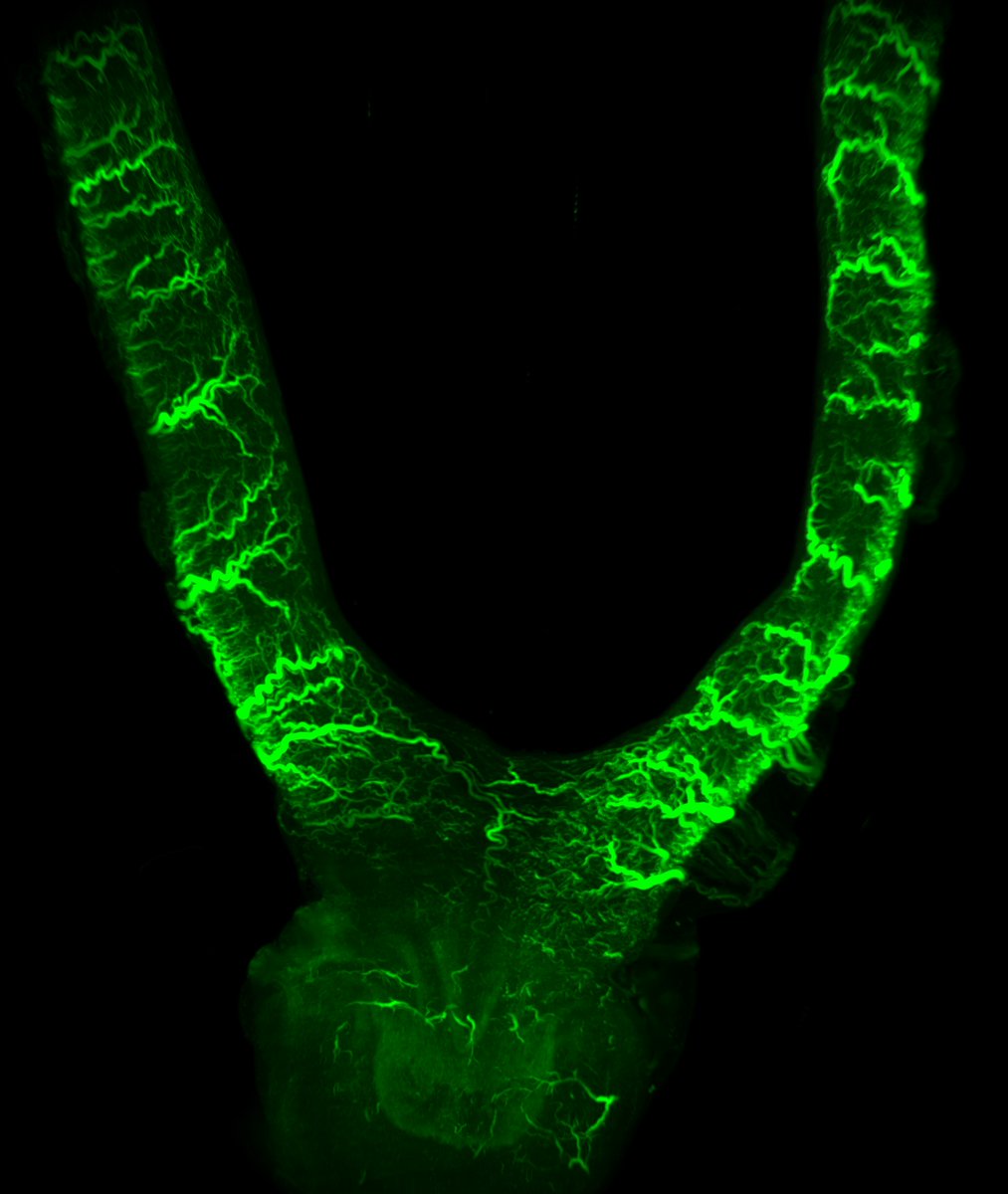 MicroMonash's tweet photo. Check out my antlers ! Nope, its uterus (Spiny mouse), our #2 MMI Image Winner, by Thomas Tapmeier (Dept Obs/Gyn, School of Clinical Sciences, Monash). Stunning image, labelled, cleared, then imaged in #Ultramicroscope. Congrats ! https://t.co/zVFwpKdlvb