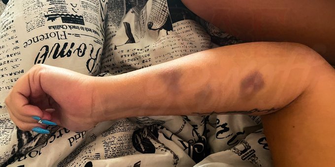 When a massive, beast, of a man like @LongliveSmalls pounds into you so hard the furniture leaves bruises<a class="tags" href="/tag/longlivesmalls">@longlivesmalls</a><a href="/tag/roughsex"class="tags"><span>#roughsex</span></a><a href="/tag/blackking"class="tags"><span>#blackking</span></a><a href="/tag/sexchair"class="tags"><span>#sexchair</span></a><a href="/tag/realsex"class="tags"><span>#realsex</span></a><a href="/tag/whiteslut"class="tags"><span>#whiteslut</span></a>