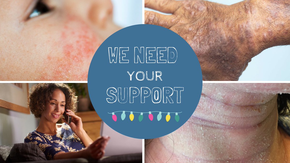 National Eczema Society tweet media