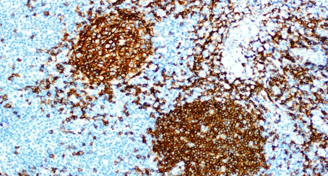 KFBIO1's tweet photo. Pathology will be sometimes a subject of science, but sometimes a subject of art, do you agree?
#pathology
#pathologyart
#pathologyimage https://t.co/4hwbin41tC