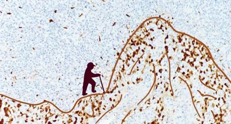 KFBIO1's tweet photo. Pathology will be sometimes a subject of science, but sometimes a subject of art, do you agree?
#pathology
#pathologyart
#pathologyimage https://t.co/4hwbin41tC