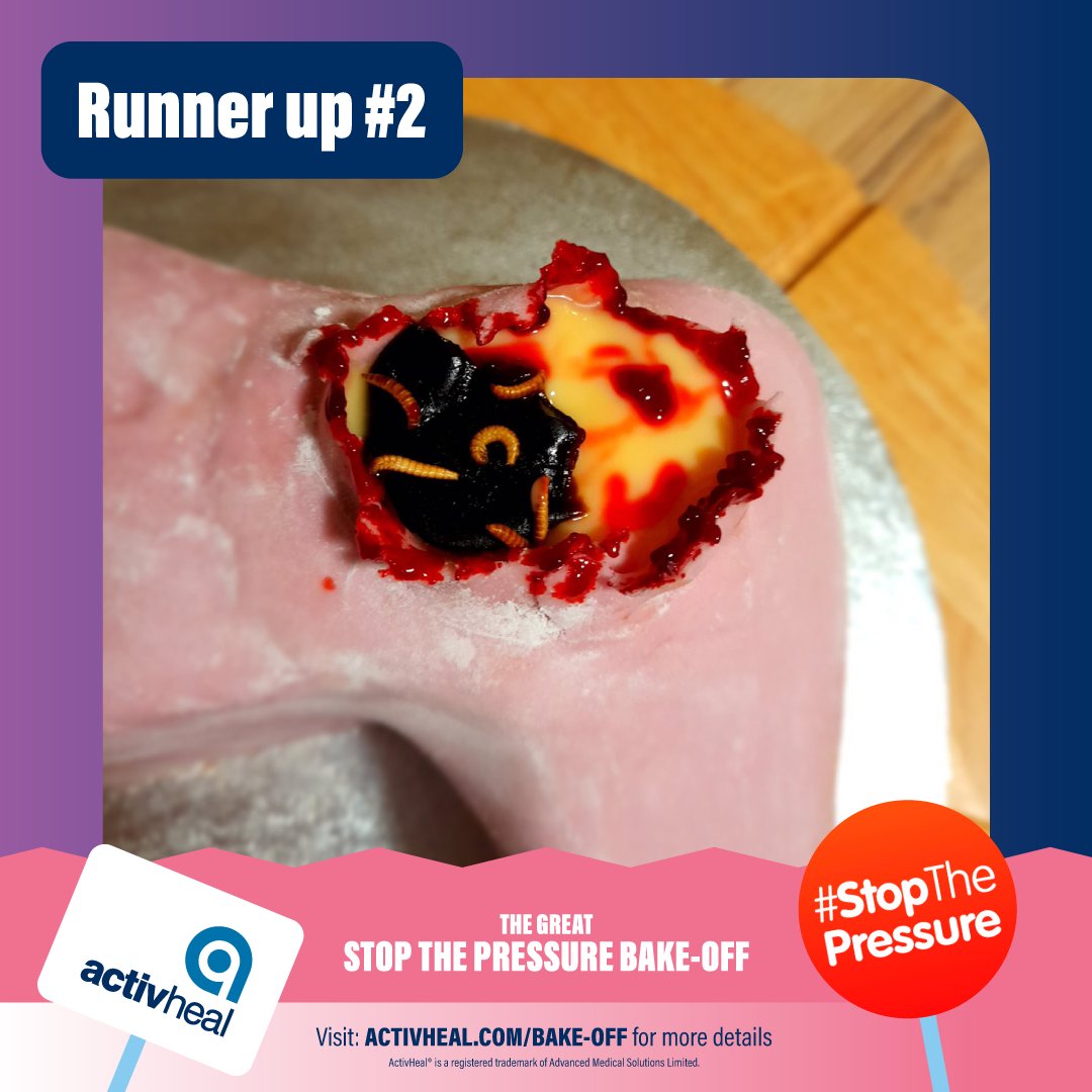 ActivHeal's tweet photo. Drumroll please...
...this year's winners and runners up are...
We will be in contact with our winners in the coming days to organise your prizes.
Well done to all of the fantastic entries!
#STOPthepressure #PressureUlcers #aSSKINg https://t.co/8NbNEh5brX