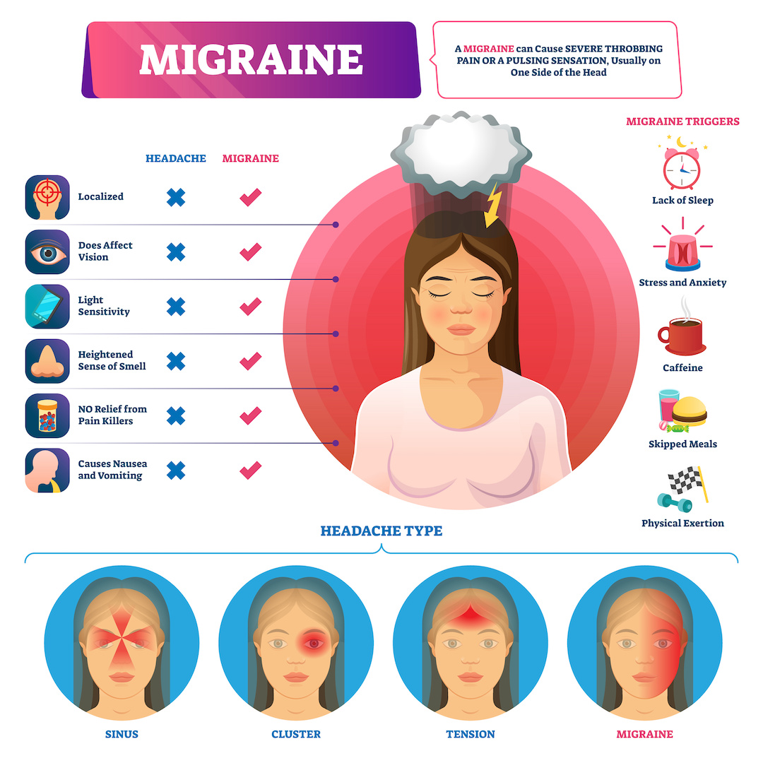 MigraineMatters's tweet photo. “A bodily force so powerful, that if it seized the whole head, the pain would be unendurable.” – The famous German abbess Hildegard of Bingen on why migraines only affects half of the head at a time… https://t.co/mzUV1D3qwb