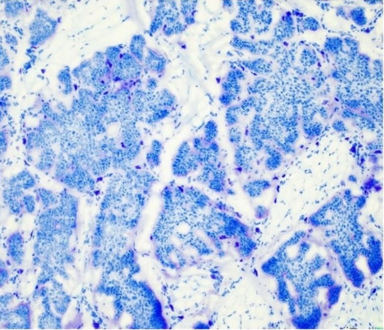 UK NEQAS CPT on Twitter "This Toluidine Blue slide (10x) exhibits good