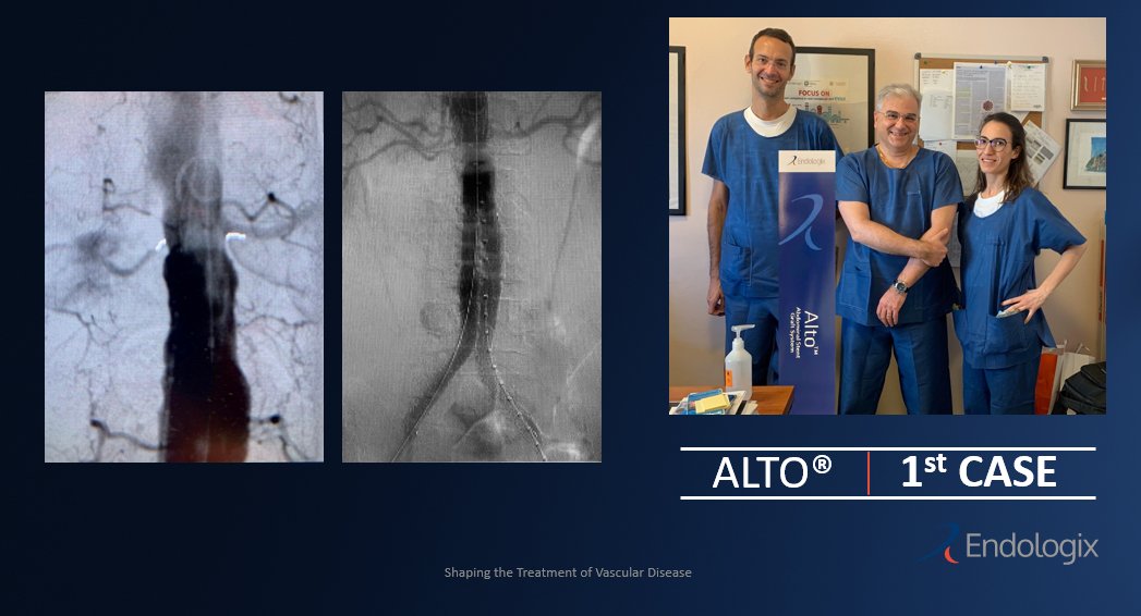 endologix's tweet photo. Another successful #ALTO case in the EU!
This is the first ALTO case in Ospedale Maggiore di Lodi, thank you to Dr. Ruggiero Curci and his team for the great job! 
Great final result for a challenging anatomy! 
#EVARevolved #aorta https://t.co/iP5WtjRobF