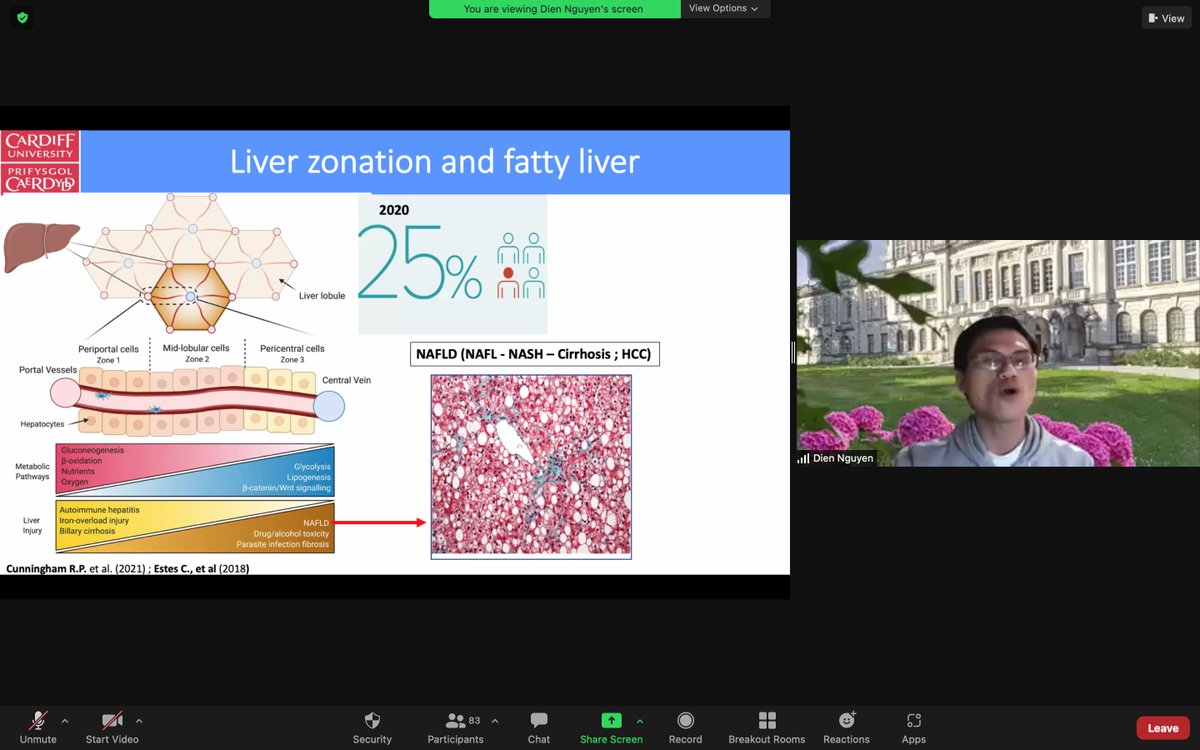 Dr. Van Dien Nguyen closing the session with a talk about complement in fatty liver disease <a href="/CUSystemsImmu/">Systems Immunity Research Institute</a> <a href="/cardiffuni/">Cardiff University</a> Infection and Immunity annual meeting 2021.