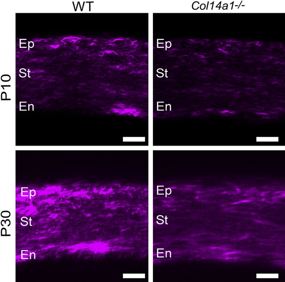 Collagen XIV is an Intrinsic Regulator of Corneal Stromal Structure and Function. Editor's Choice article is from authors <a href="/USFHealth/">USF Health</a>,  <a href="/umiamimedicine/">Miller Medicine</a>, <a href="/UNALOficial/">Universidad Nacional de Colombia</a>, and <a href="/UniCologne/">Universität zu Köln</a>. Full text is FREE at ajp.amjpathol.org/article/S0002-….