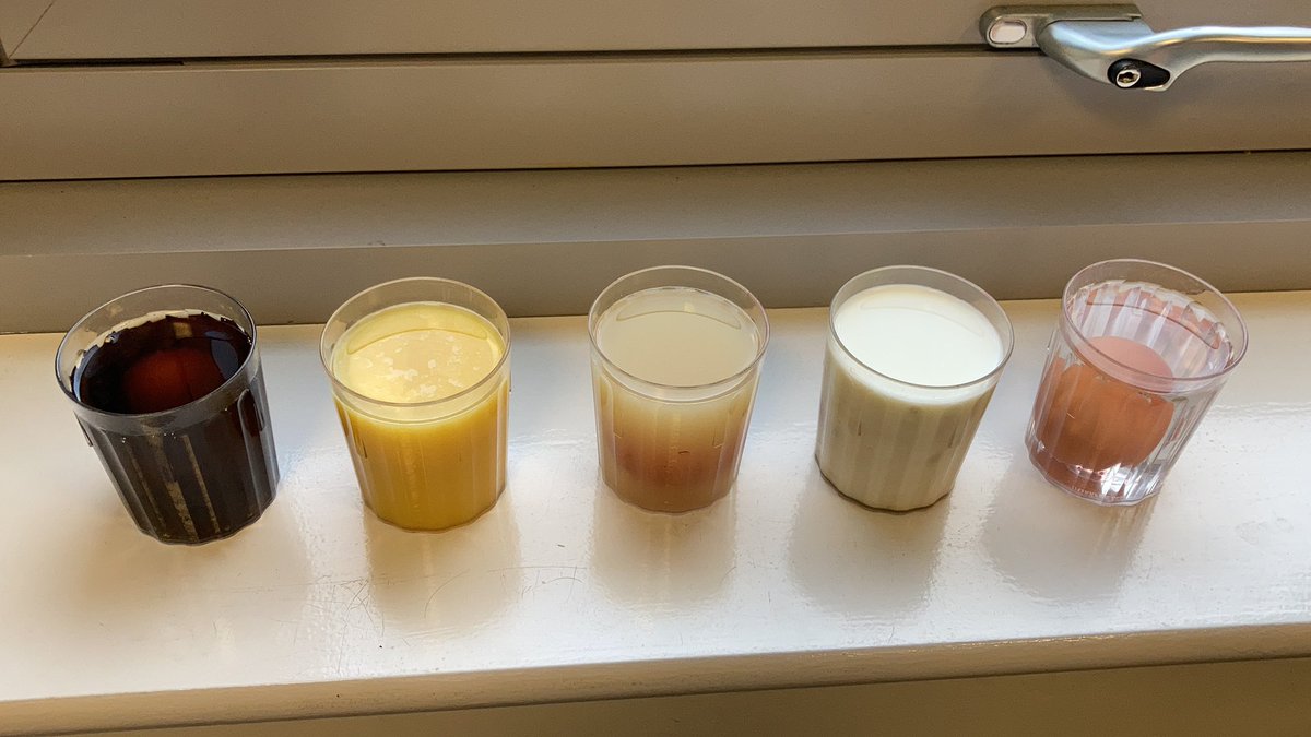 What do you predict will happen to the eggs? 🥚 <a href="/HartfordmanorY5/">Y5</a> <a href="/hartfordmanory4/">HartfordManorY4</a> <a href="/HartfordManorN/">HM Nursery</a>