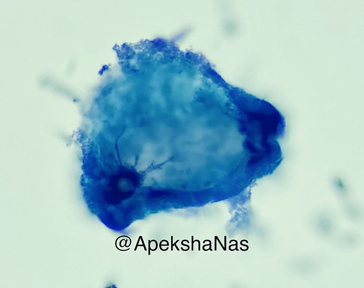 ApekshaNas's tweet photo. Happy Friday! 

#cytology #pathart #papstain https://t.co/XGKYhCJlgz
