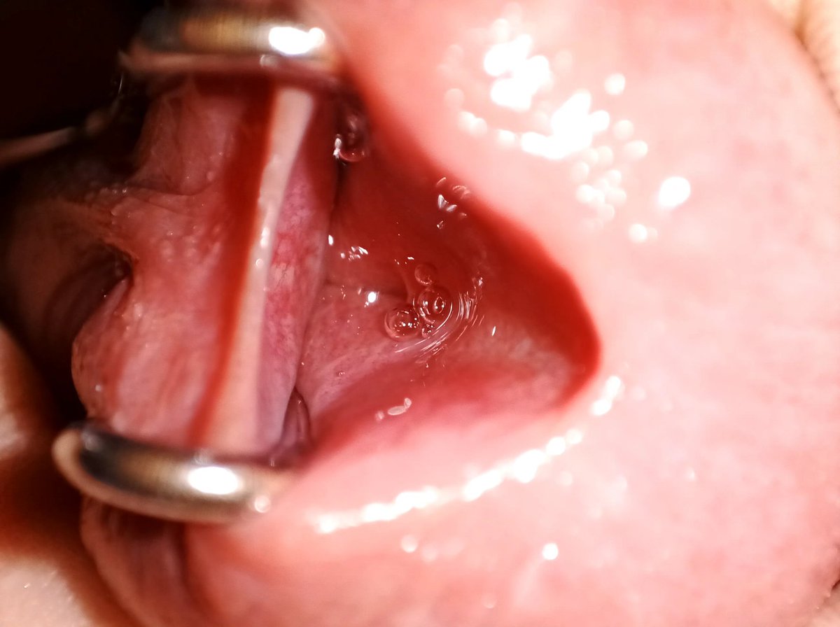 openpeehole's tweet photo. 来一张极��近距离 https://t.co/QbauYB865J
