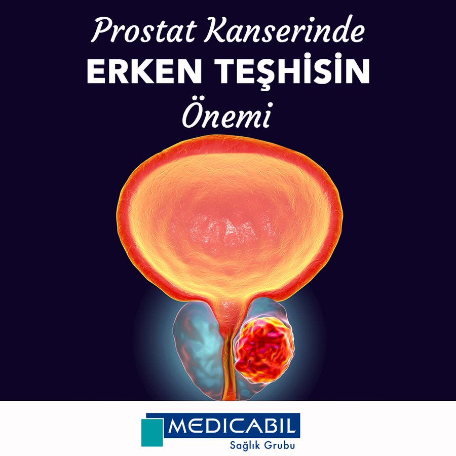 Prostat Kanserinde Erken Teşhis