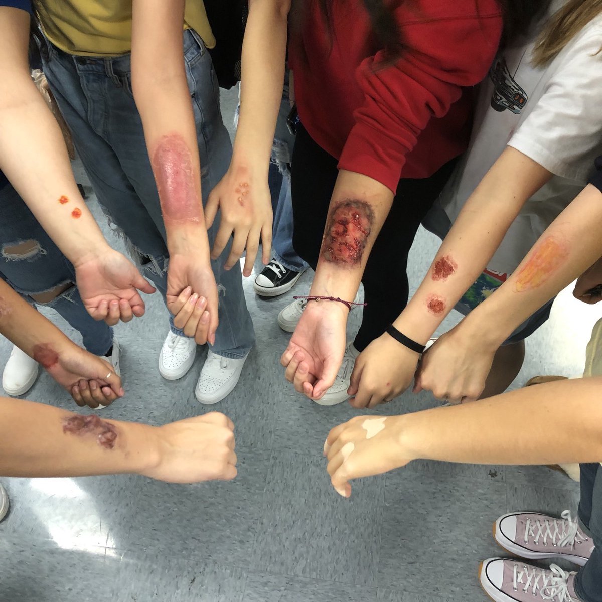 Healthsciencs's tweet photo. Hands on learning! Integumentary disease moulage project. Third degree  burns, ecchymosis, vessicles and more! This is one of my favorite projects ever!
#kleincollinsmakedecembermagic https://t.co/iDmZHMp50t