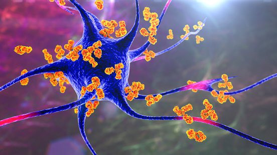 CUNY ASRC (@asrc_gc) on Twitter photo Check out this story to learn how researchers in the lab of Neuro Initiative Dir. Patrizia Casaccia are homing in on a protein that appears to play a role in advancing multiple sclerosis. bit.ly/31LyAHM <a href="/GC_CUNY/">The Graduate Center</a> @GCSciences Check out this story to learn how researchers in the lab of Neuro Initiative Dir. Patrizia Casaccia are homing in on a protein that appears to play a role in advancing multiple sclerosis. bit.ly/31LyAHM <a href="/GC_CUNY/">The Graduate Center</a> @GCSciences