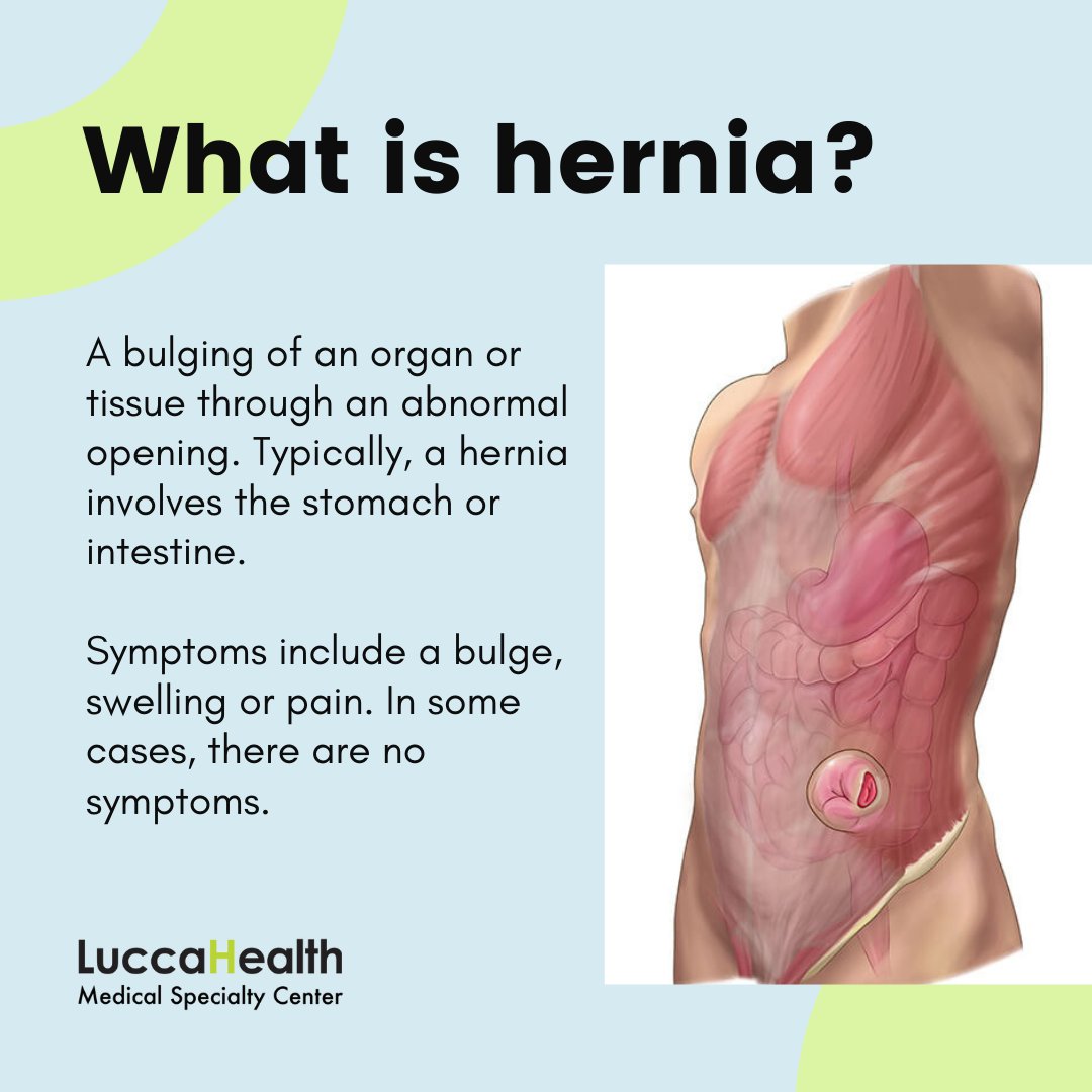 LuccaHealthMSC's tweet photo. The longer you wait to address #Hernia, the harder it can be to fix. As with everything, early detection makes different surgical options possible. General Surgeon Dr. Rakovets is an expert in #HerniaRepairs &amp; is available Mon - Fri. Please call 0544120777 to book an appointment. https://t.co/f6pp8ZmOCM