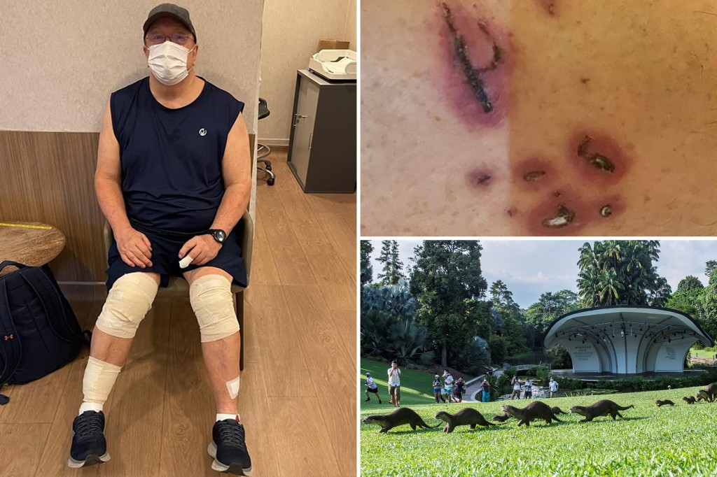 nypost's tweet photo. Man attacked by gang of otters, bitten 26 times: 'I thought I was going to die' https://t.co/SSY7PJm5MH https://t.co/iip4BFgxal